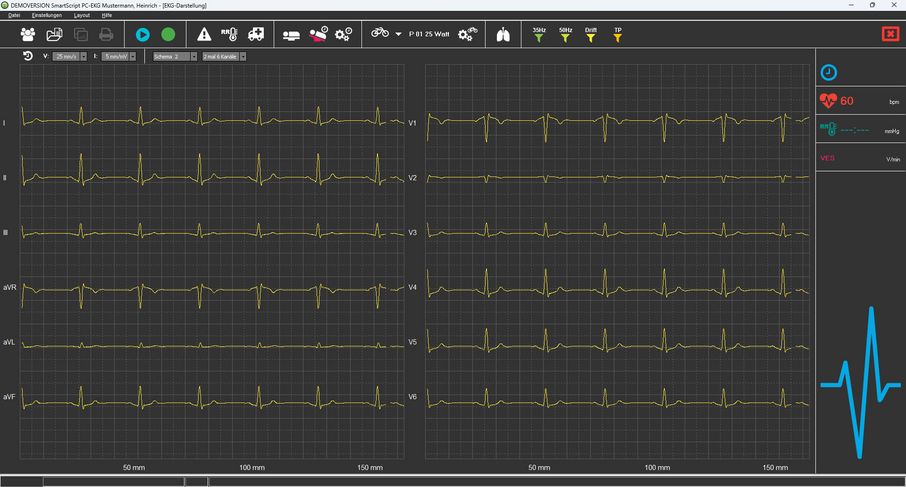 SmartScript Ruhe-EKG