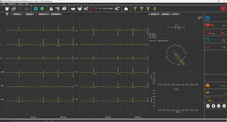 SmartScript Belastungs-EKG