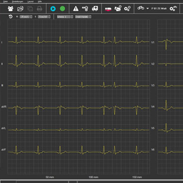 Ruhe / Rhythmus-EKG-Software